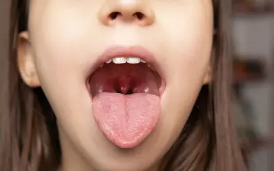 Jak uniknąć anginy? Skuteczna profilaktyka i wzmocnienie odporności