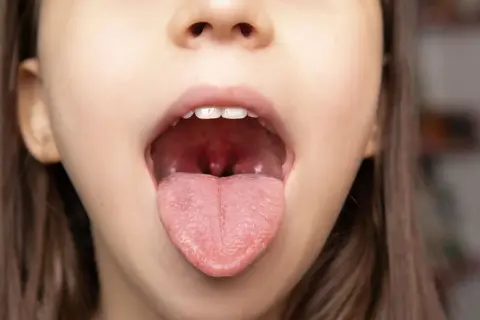 Jak uniknąć anginy? Skuteczna profilaktyka i wzmocnienie odporności